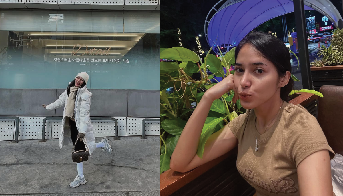Dilan Janiar Jalani Operasi Plastik di Korea.