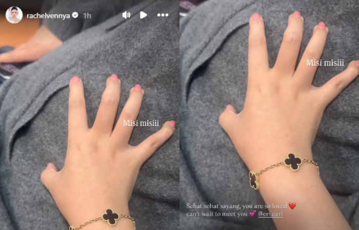 Rachel Vennya pamerkan baby bump Erika Carlina.