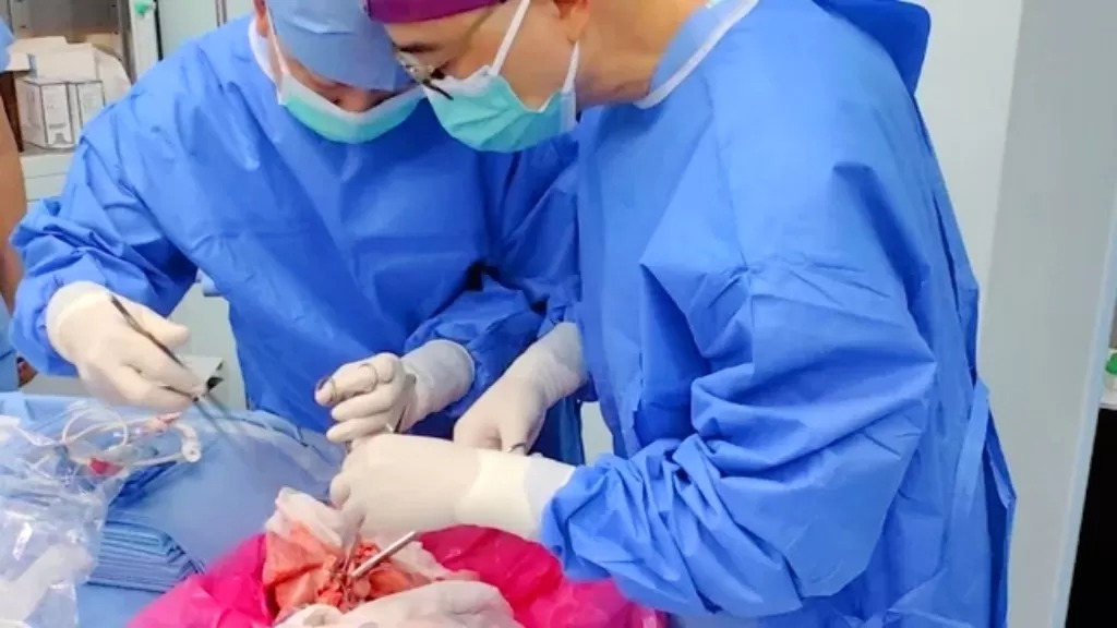 Tim medis di First Affiliated Hospital of Guangzhou Medical University berhasil melakukan transplantasi paru-paru babi ke manusia untuk pertama kalinya di dunia.