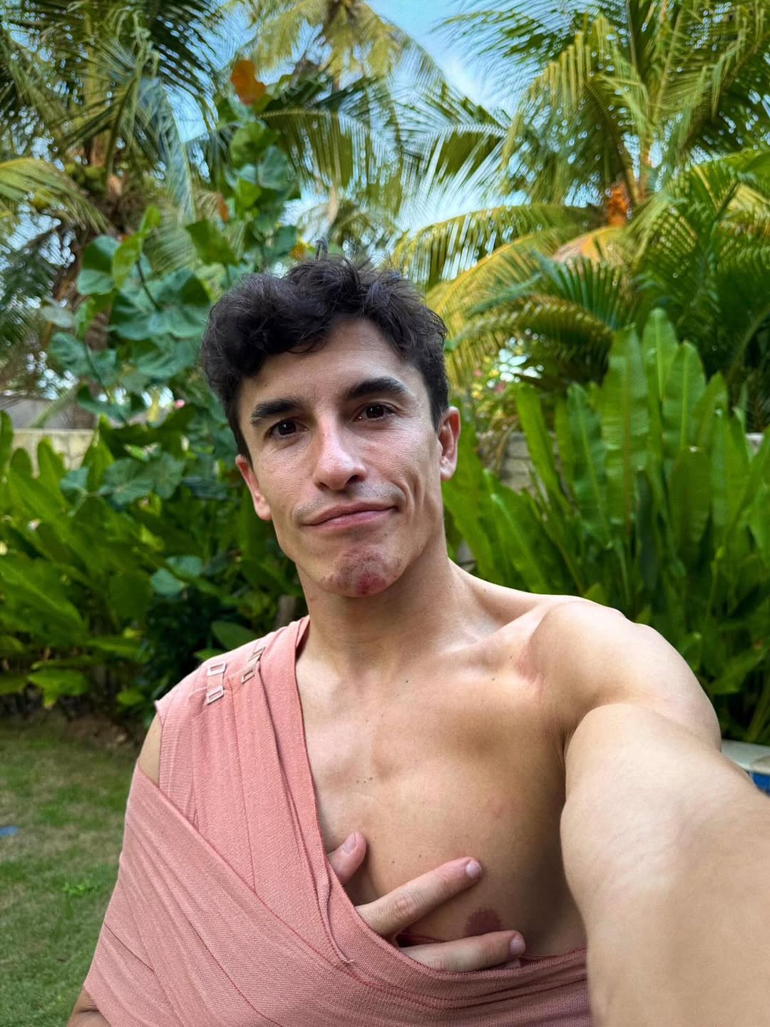 Marc Marquez pamer kondisi terkini usai alami crash di MotoGP Mandalika 2025.