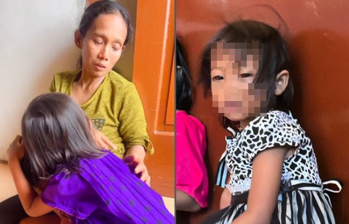 Fatiyah, siswi SD di Palembang pulang sekolah dengan mata merah bak berdarah.