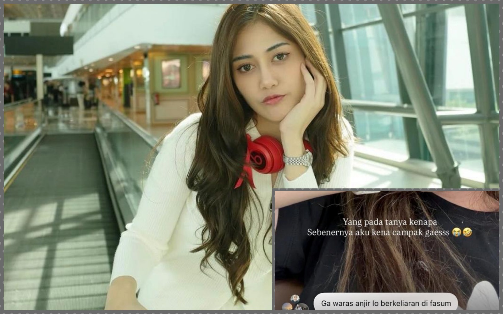 Kolase Foto Ruce Nuenda kena campak dan berkeliaran, bikin netizen murka. 