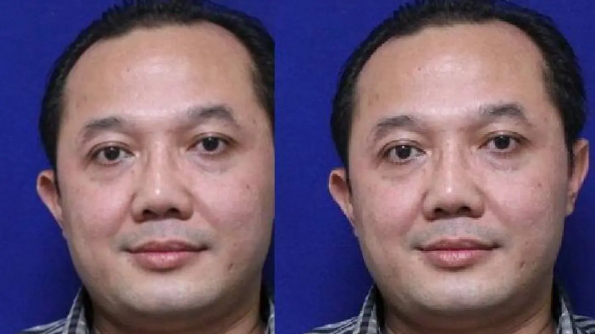 Asep Yusuf Somantri.