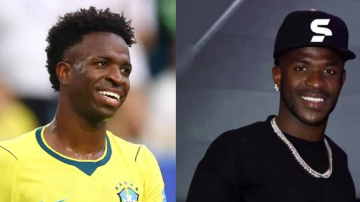 Perubahan Wajah Vinicius Jr Hasil Tangan Dokter Bedah.