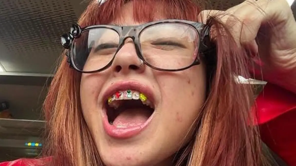 pengunaan Tooth gems. (IG. naykillaaa)
