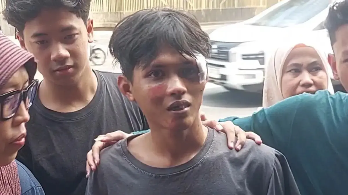 Faturrohman, 19, kembali ke rumahnya setelah menjadi korban penganiayaan oleh kelompok orang tidak dikenal (OTK) saat pembubaran massa demonstrasi di kawasan Pejompongan Raya, Tanah Abang, Jakarta Pusat. (Ryandi Zahdomo/JawaPos.com)