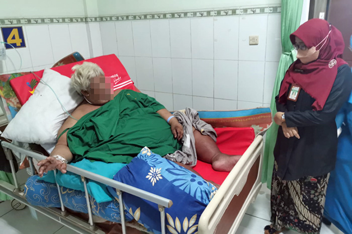 PERAWATAN: Pria obesitas, Sumarlan, saat mendapatkan perawatan di Ruang Gladiol RSUD dr Soedjati pada Senin (3/7).