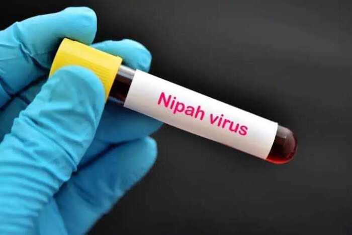 Ilustrasi Virus Nipah