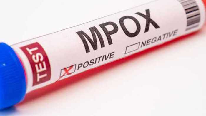 Ilustrasi virus Mpox alias cacar monyet