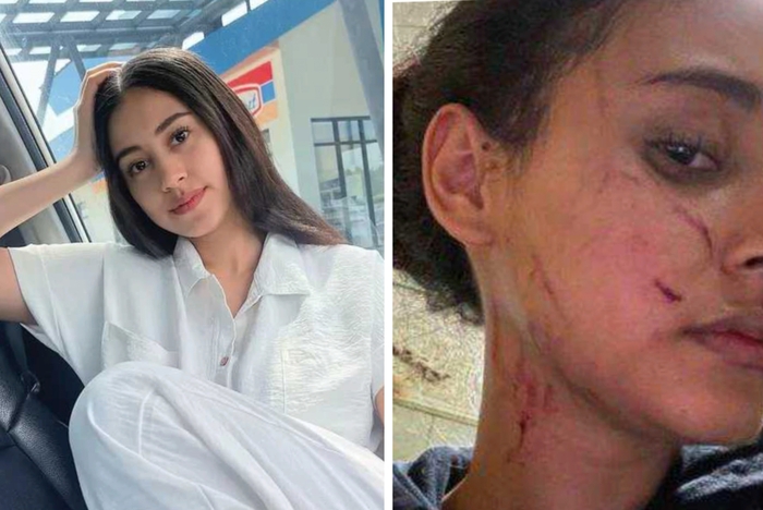 Selebgram Afifah Riyad mengaku mengalami penganiayaan yang dilakukan mantan pacar suaminya.