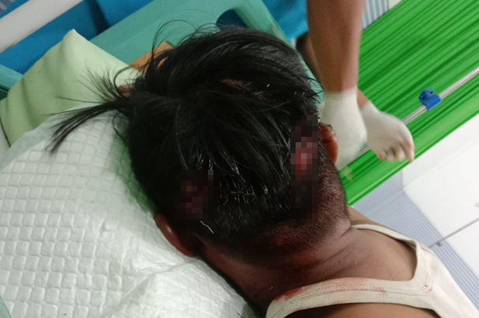 ALAMI LUKA: Korban TR, warga Desa Penganten, Kecamatan alami luka di Kepala, lebam di muka dan di kaki usai mendapatkan dugaan penganiayaan dari Sutrisno, warga Desa Taruman, Klambu.