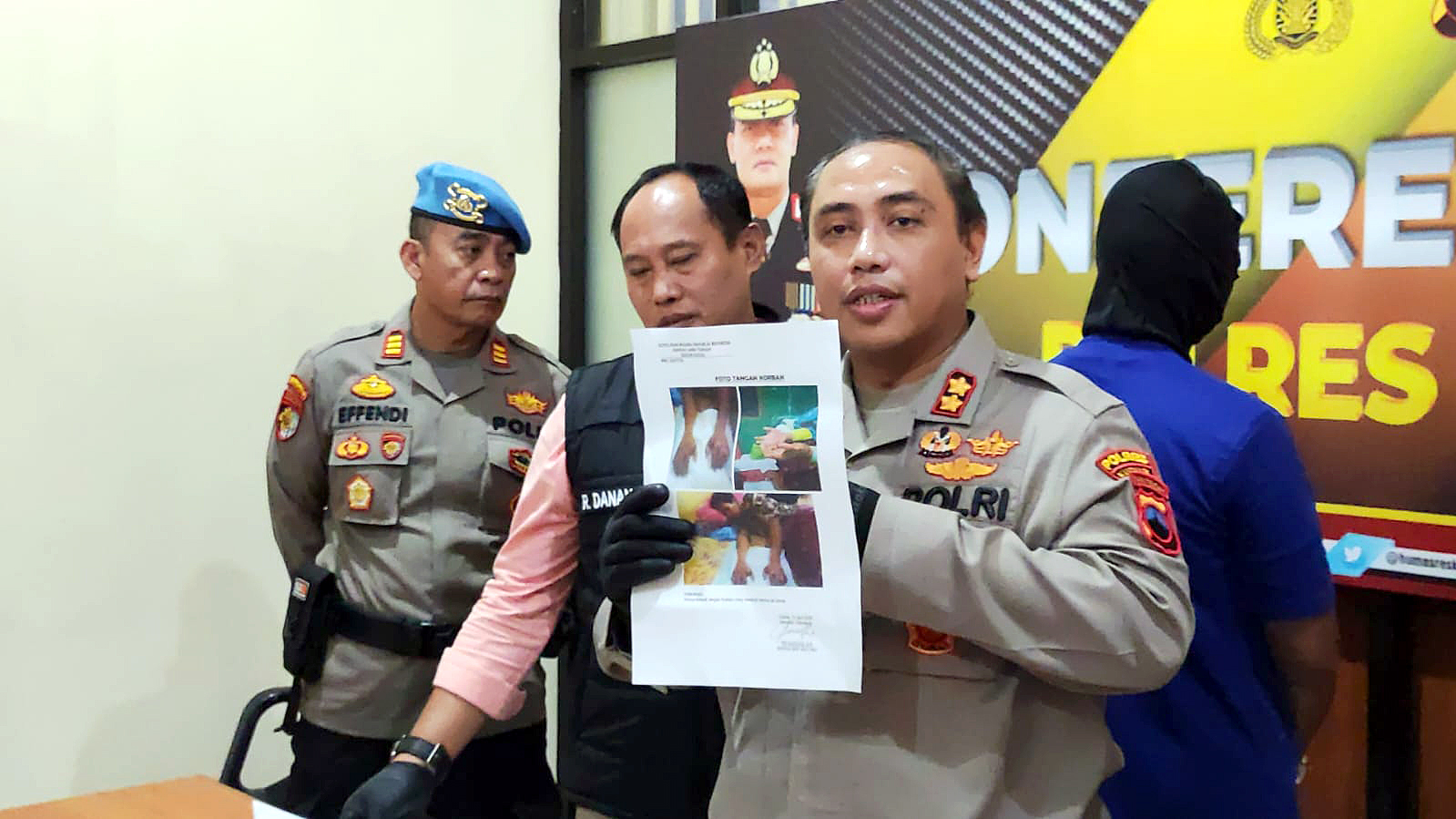 MERUGIKAN SANTRI: Polisi menunjukkan foto dua tangan santri yang melepuh diduga akibat kekerasan yang dilakukan oleh pengurus salah satu ponpes di Kecamatan Dawe, Kudus.
