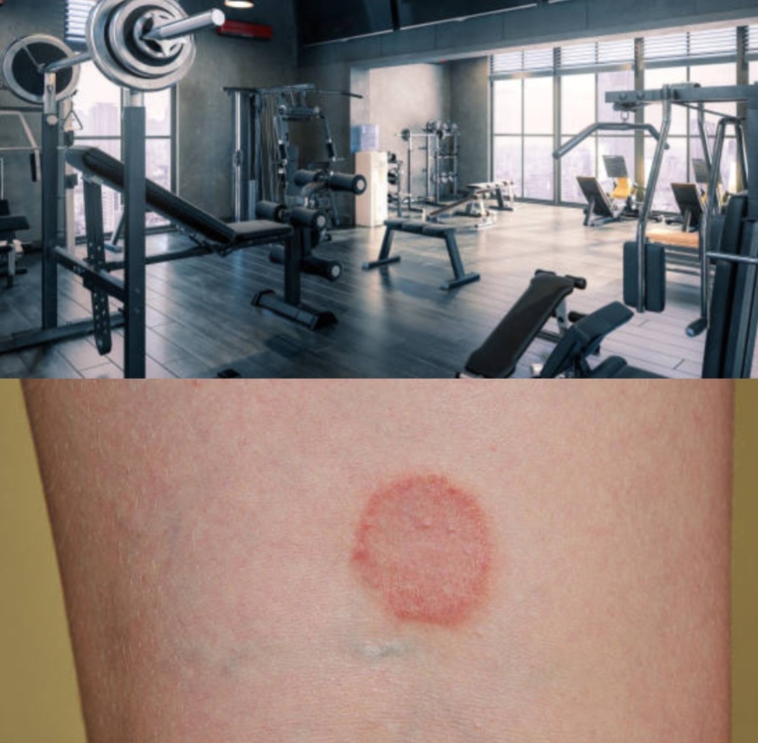 Foto atas: gym. Foto bawah: bentuk ringworm. Sumber: istockphoto.com