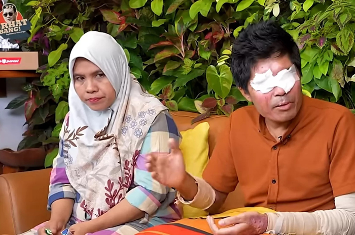 Agus Salim yang disiram air keras dan Wawa (Bibinya)