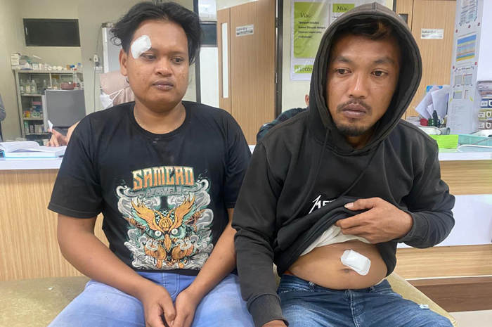 DIANIAYA: Dua warga Desa Jurangjero alami penganiayaan usai protes perusahaan tambang milik PT KRI.