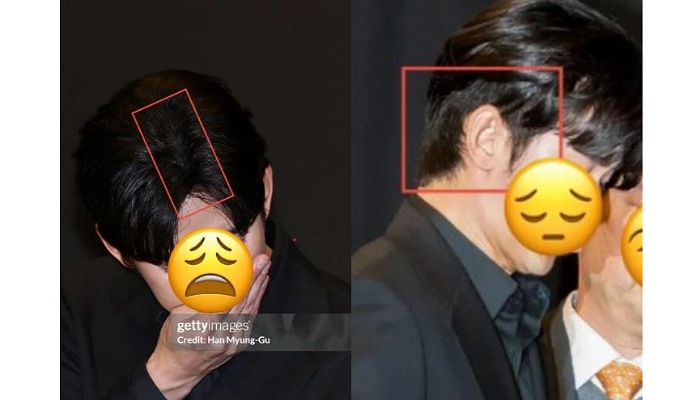 Kim Soo Hyun saat konferensi pers tanggal 31 Maret 2025 (Foto kanan : Top Star News, diunduh dari laman Koreaboo. Kiri : Han Myung Gu/Getty Images, diunduh dari postingan X @whereiszyx)