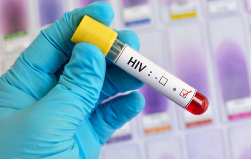 Illustrasi HIV