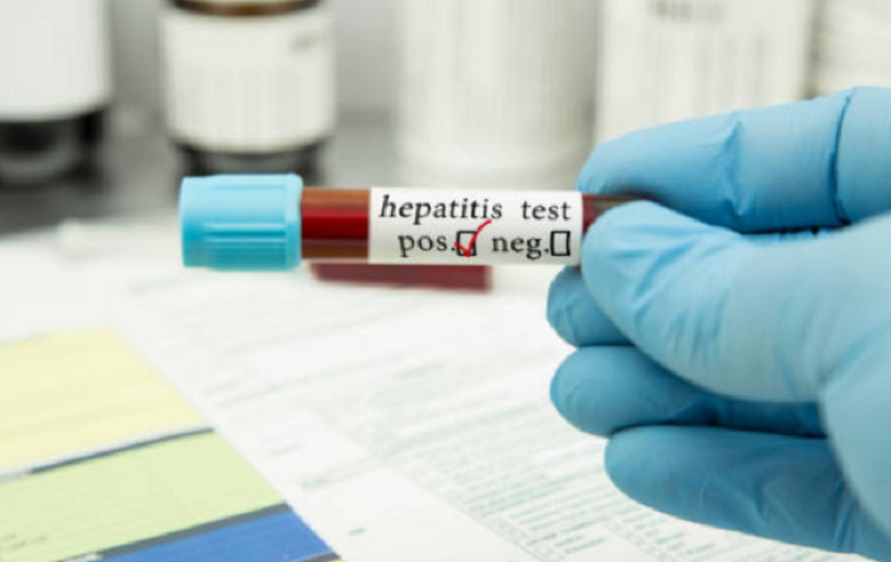Ilustrasi tes Hepatitis