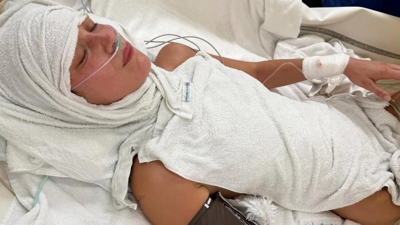 Kondisi Bella Hadid yang dikabarkan dirawat karena penyakit Lyme