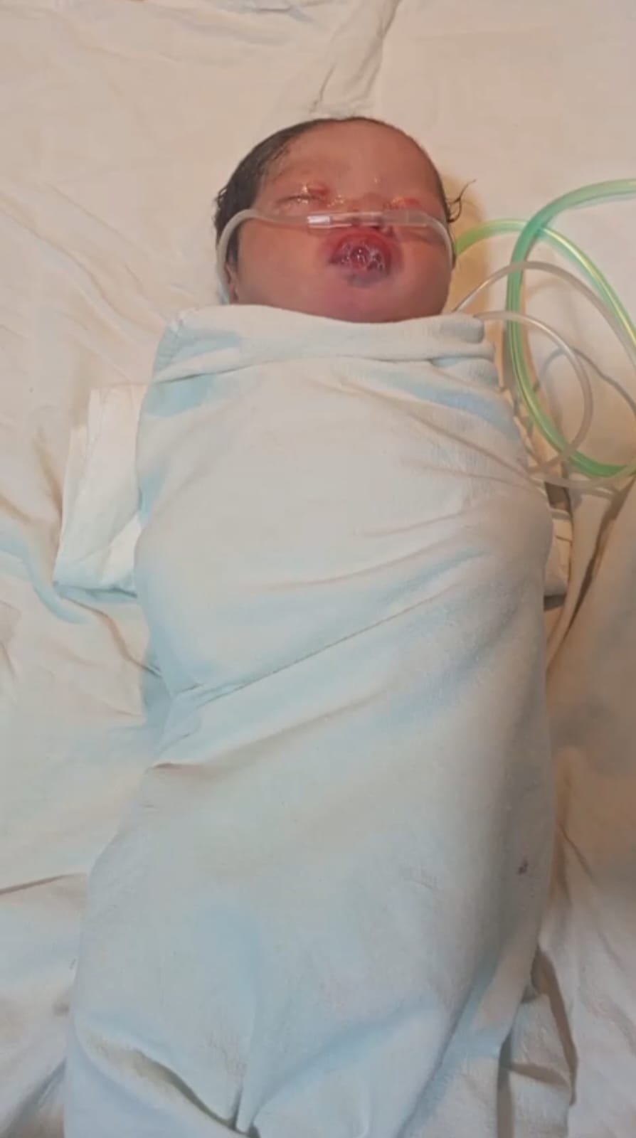TERUS MEMBAIK: Kondisi bayi laki-laki yang dibuang ke laut sehat dan dirawat intensif di RSUD Rembang.