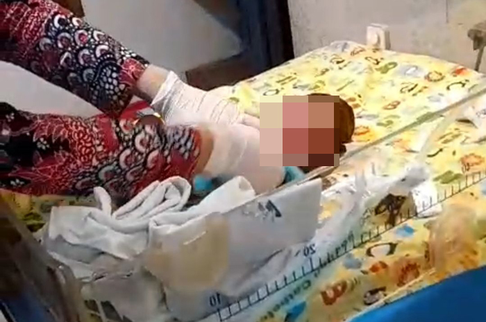 DIRAWAT INTENSIFE: Bayi laki-laki yang dibuang ke laut masih selamat dan dirawat intensif di RSUD dr. Soetrasno Rembang.