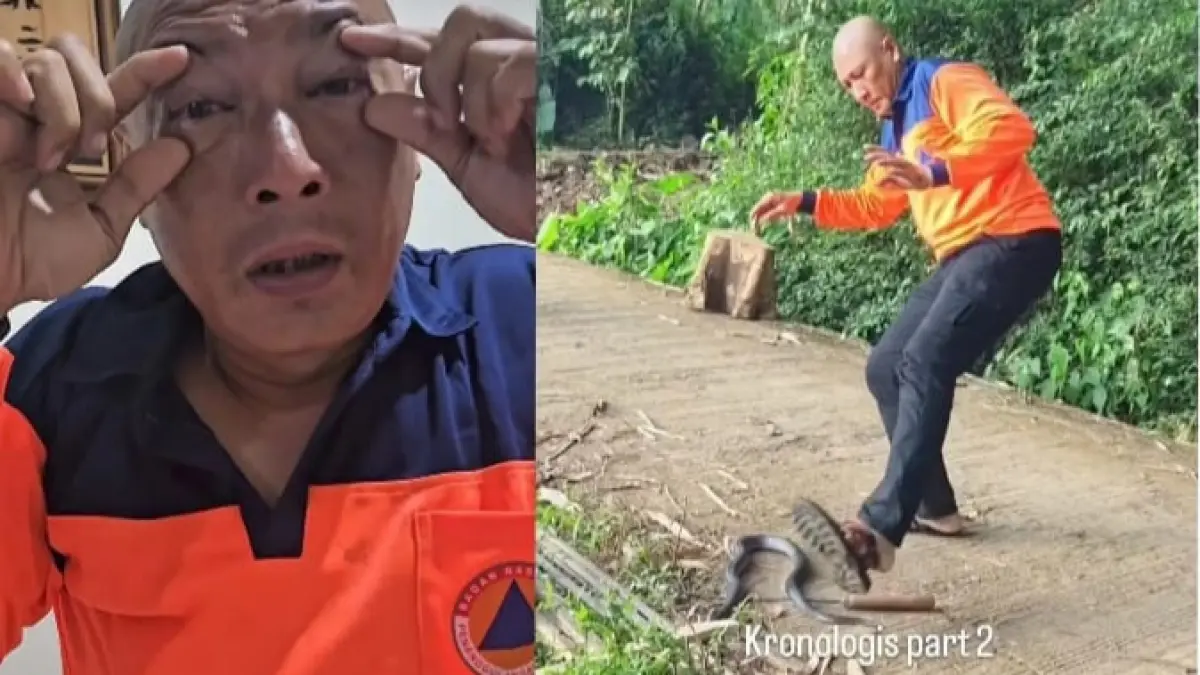 Mata Heru presenter Jejak Si Gundul terkena bisa ular cobra (Foto: Instagram @heru_gundul) 