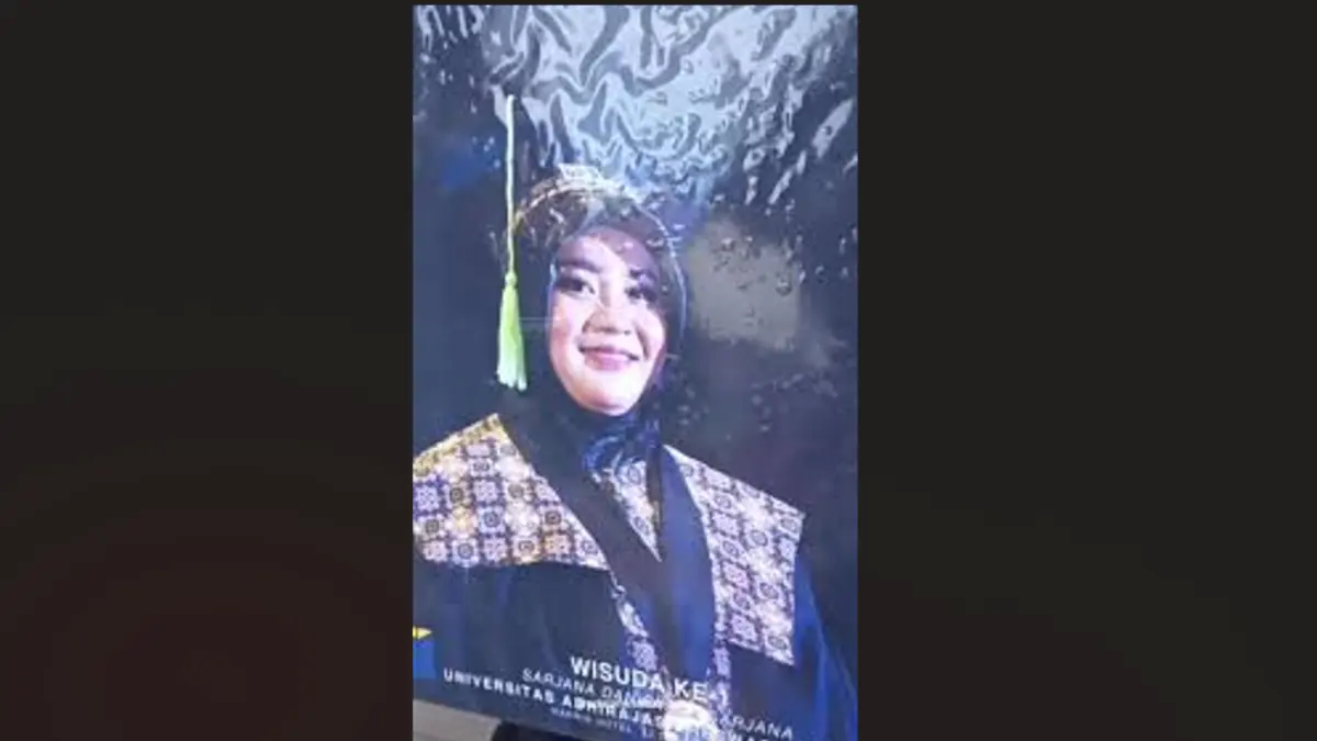 RSHS Kerahkan 40 Dokter Spesialis demi Rekonstruksi Wajah Yuvita, Pemprov Jabar Kucurkan Rp1 Miliar