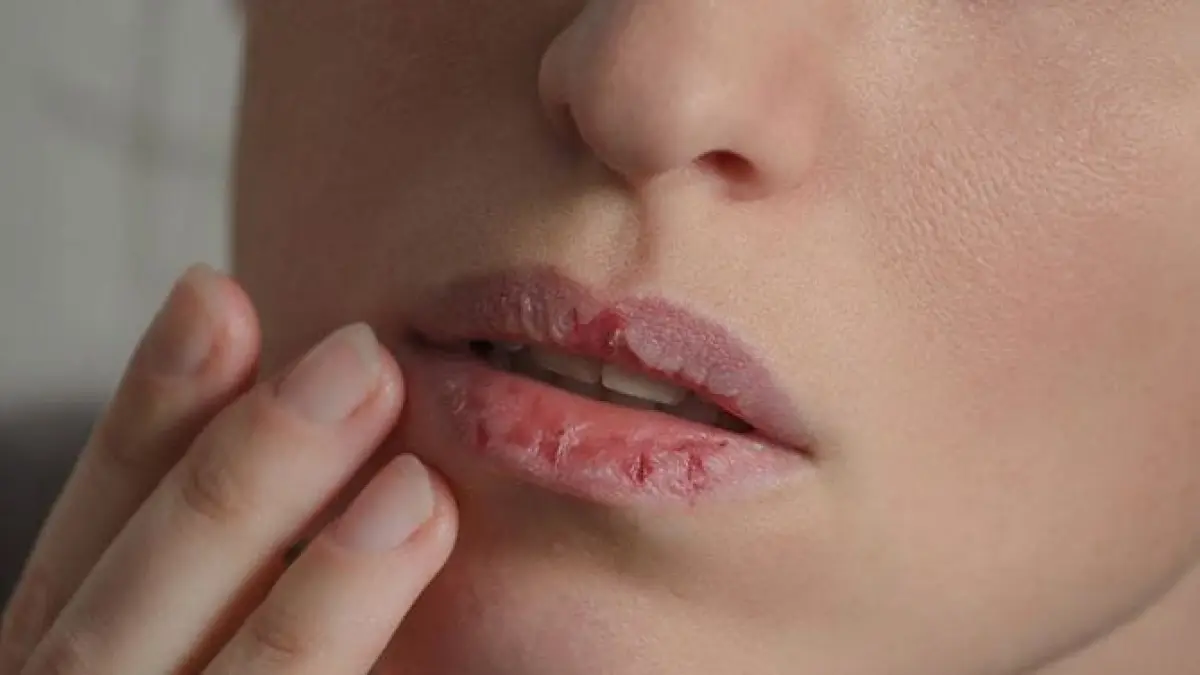 Tips melembapkan bibir secara alami (sanook)