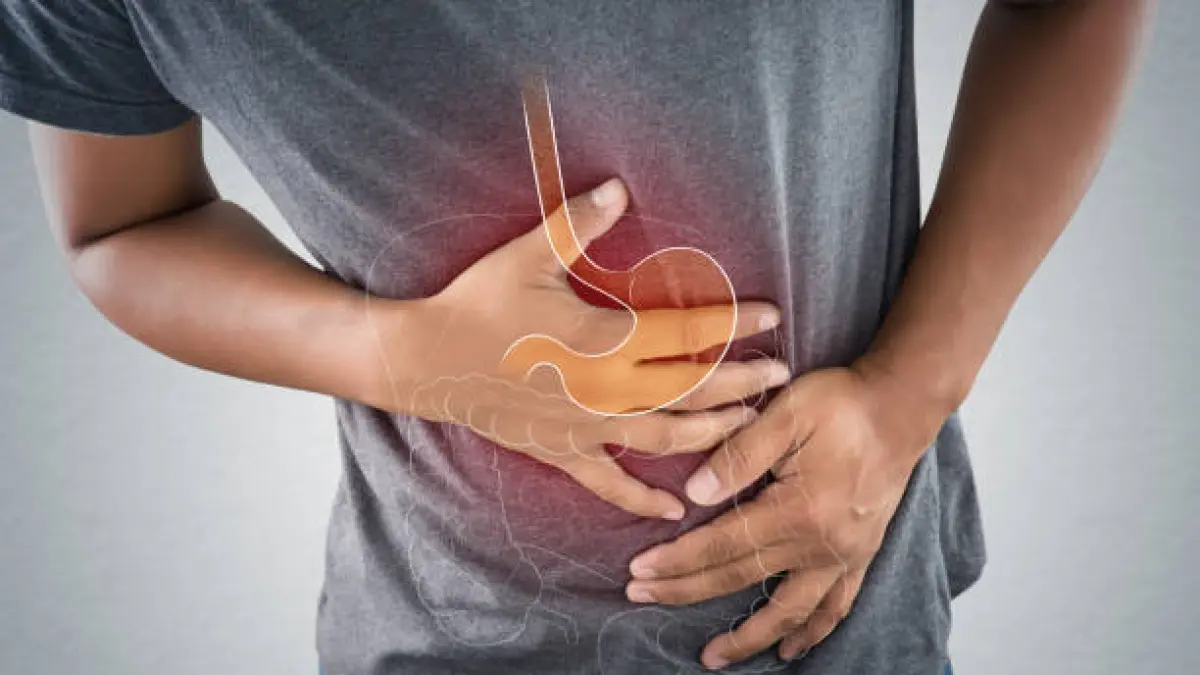 Perbedaan GERD, Maag, dan Gastritis: Penyebab, Gejala, dan Pemicunya pada Usia Muda