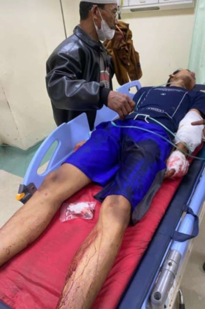 TERKAPAR: Warga Desa Geritan dirawat di RSUD RAA Soewondo tadi malam.