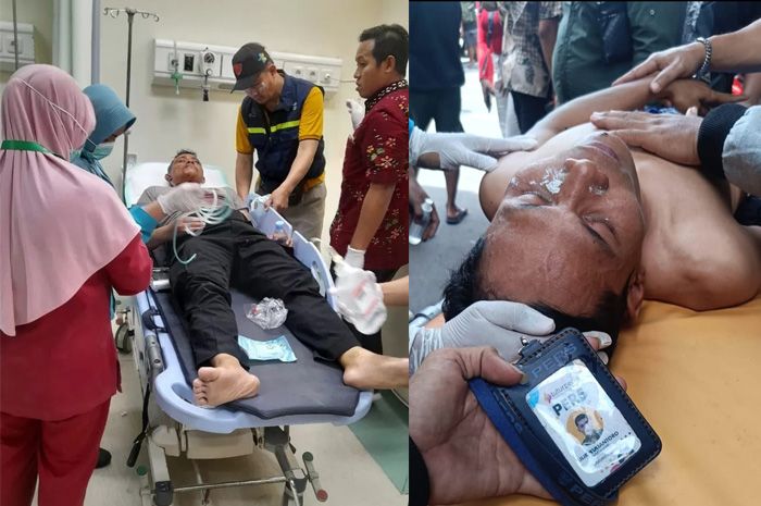 KIRI-KANAN: Kapolsek Kota Pati, Iptu Heru Purnomo, dan seorang jurnalis bernama Lilik Yuliantoro alami luka akibat unjuk rasa.