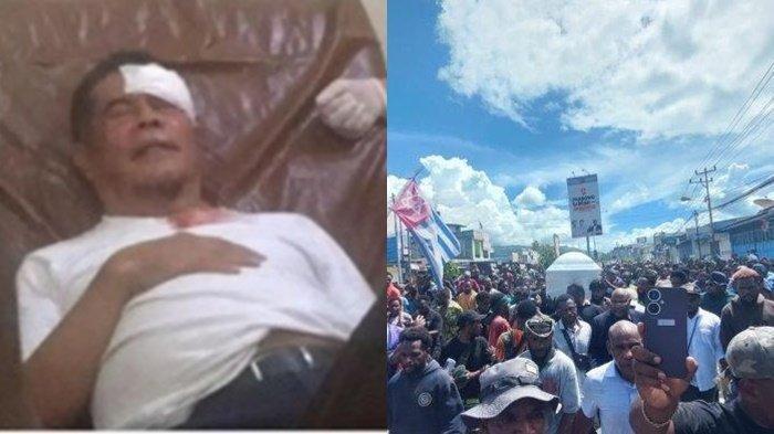 (kiri) Kondisi PJ Gubernur Papua, Ridwan Rumasukun usai dikabarkan kena lemparan batu saat iring-iringan jenazah Lukas Enembe dan (kanan). (Foto : Instagram @kabarnegri/Tribun-Papua.com/Noel Wenda)