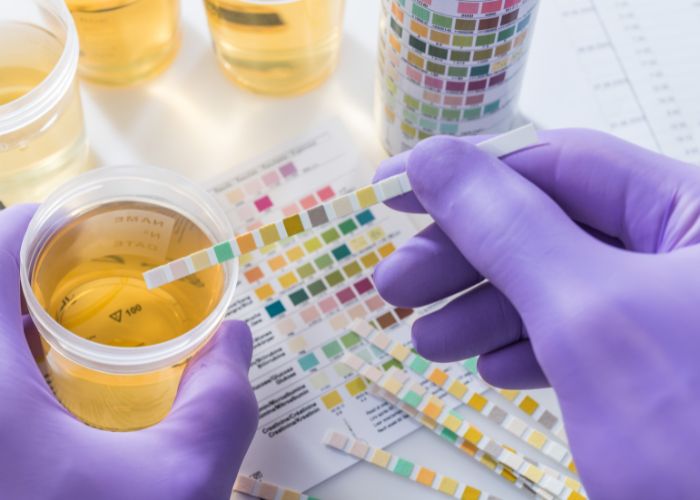 Urine Anda Berwarna Kuning? Ini yang Harus Anda Ketahui dari Studi Baru yang Dilakukan oleh Universitas Maryland dan NIH.