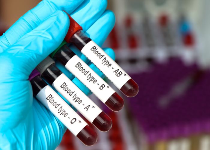 3 Cara Praktis Mengidentifikasi Golongan Darah dan Fungsinya untuk Keseimbangan Tubuh.