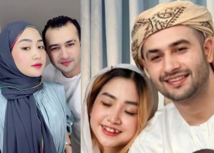Kondisi Venny Alberti Pasca Diduga Terkena Penyakit Menular Seksual