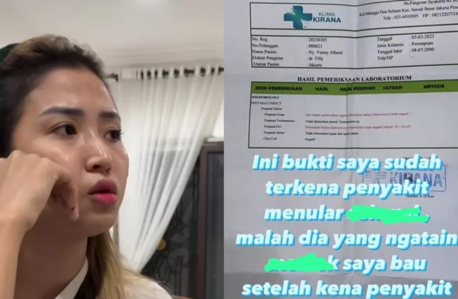 Teridap Penyakit Menular, Tiktoker Venny Alberti Berikan Pesan Penting untuk Wanita Indonesia, Katanya Jangan Mau Sama...(Foto: bondowoso.jatimnetwork.com)