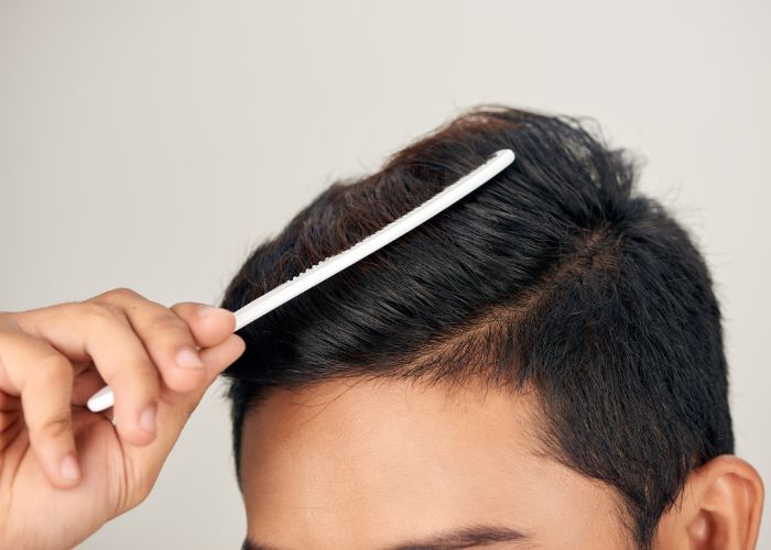 Ilustrasi Cara Menumbuhkan Rambut Sehat dan Cegah Kerontokan