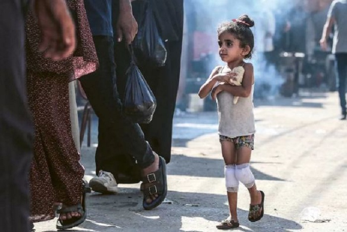 SITUASI SULIT: Seorang bocah perempuan Palestina yang kedua lututnya dibebat perban memegang roti di Deir Al Balah, bagian tengah Jalur Gaza (13/6). (AFP)