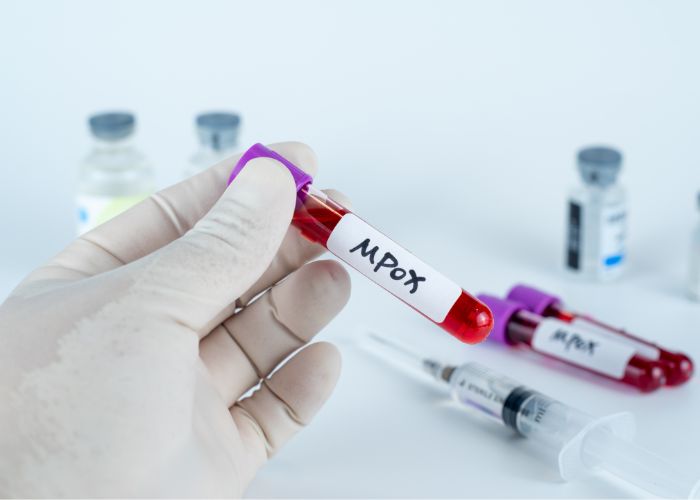 Ilustrasi Virus Cacar Monyet/MPOX