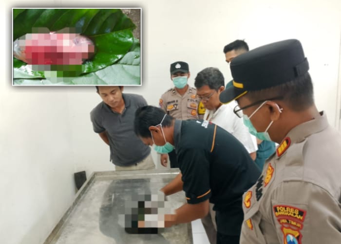 Petugas melakukan uji Forensik pada penemuan yang diduga janin manusia.