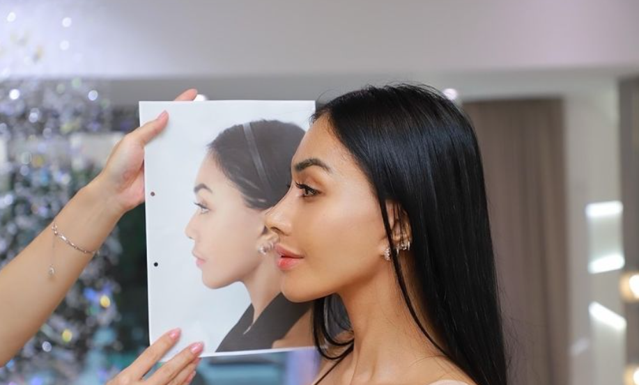 Denada ketika melakukan operasi plastik (oplas) hidung. Ia melakukannya untuk mempertahankan kariernya.(Dok. Instagram.com/denadaindonesia)