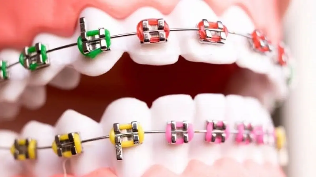 Sumber Foto: Joy Dental