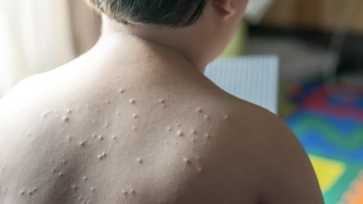Ilustrasi - Virus Paling Mematikan di Dunia dan Dampaknya bagi Umat Manusia