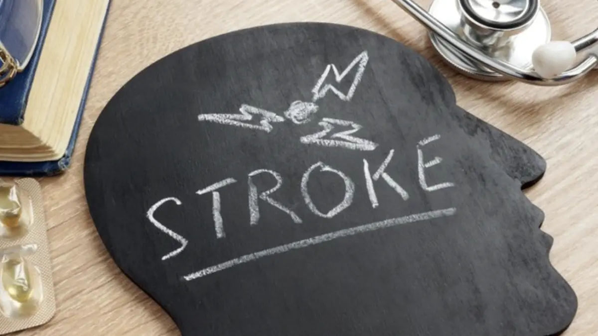 Foto: Ilustrasi stroke (Getty Images/iStockphoto/designer491)