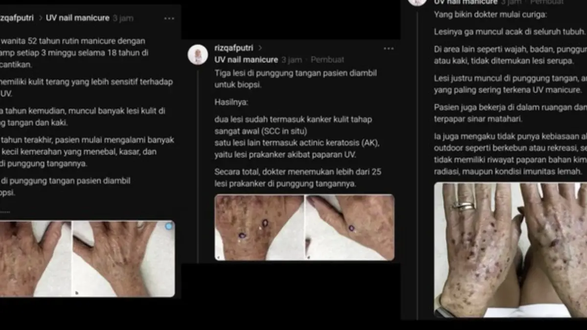 Foto: Tangkapan layar Threads @rizkafputri atas izin yang bersangkutan.