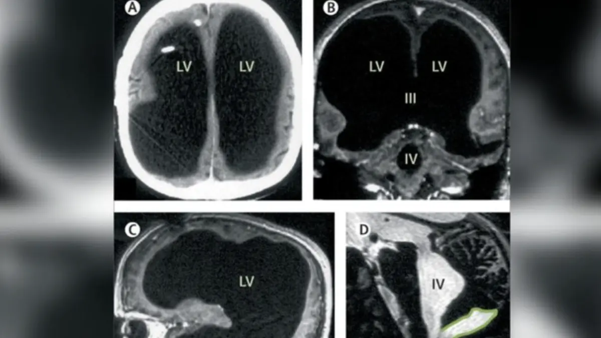 Foto: Jurnal The Lancet