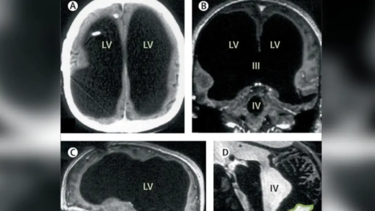 Foto: Jurnal The Lancet