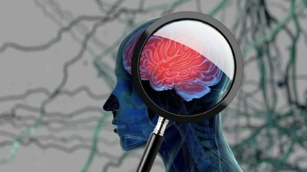 Foto: ilustrasi/thinkstock
