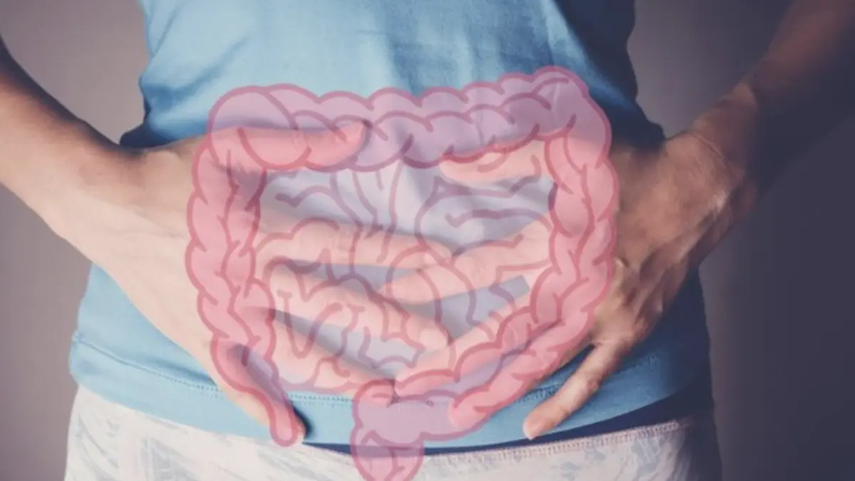 Ilustrasi usus (Foto: Getty Images/iStockphoto/Sewcream)