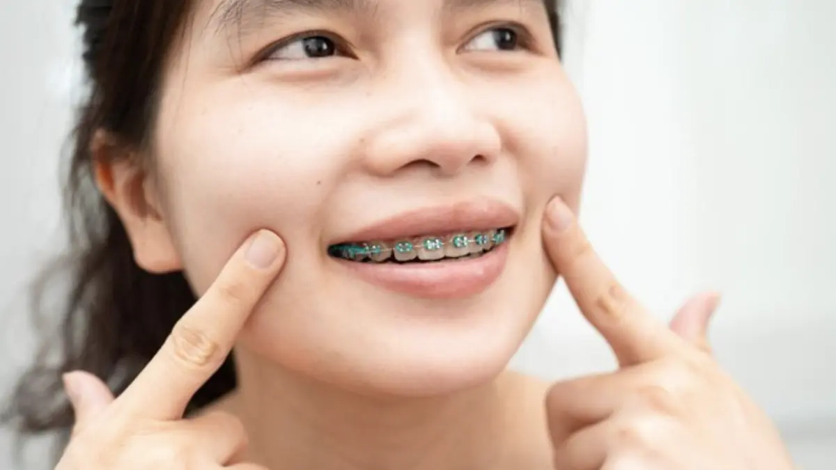 Pengguna behel sering mengalami momen iyup. Foto: Getty Images/sasirin pamai